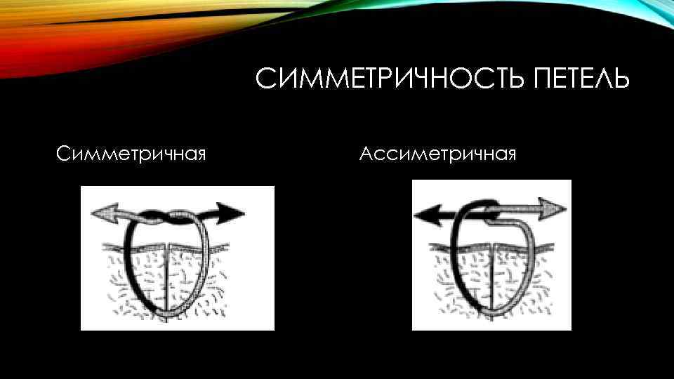 СИММЕТРИЧНОСТЬ ПЕТЕЛЬ Симметричная Ассиметричная 