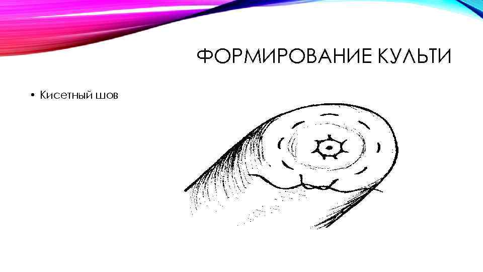 ФОРМИРОВАНИЕ КУЛЬТИ • Кисетный шов 
