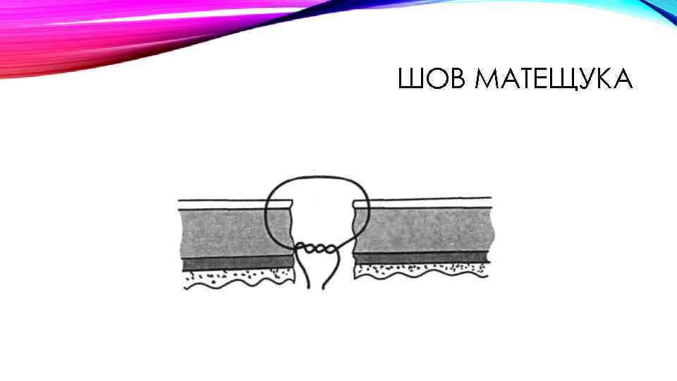 ШОВ МАТЕЩУКА 