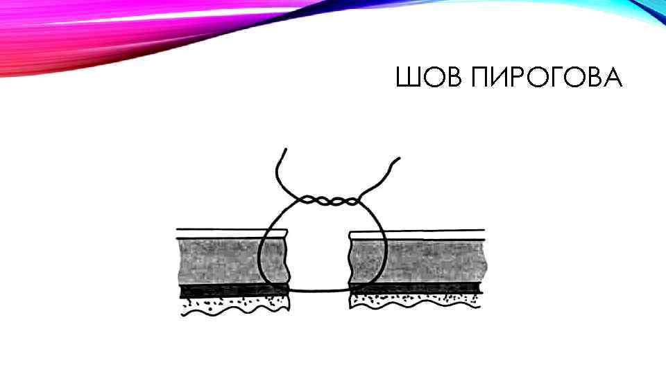 ШОВ ПИРОГОВА 