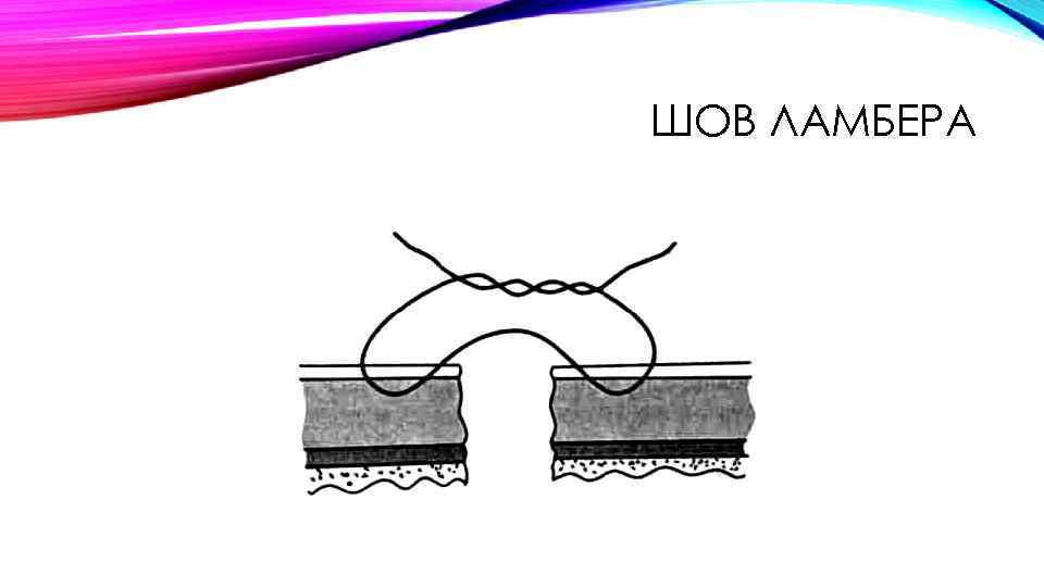 ШОВ ЛАМБЕРА 