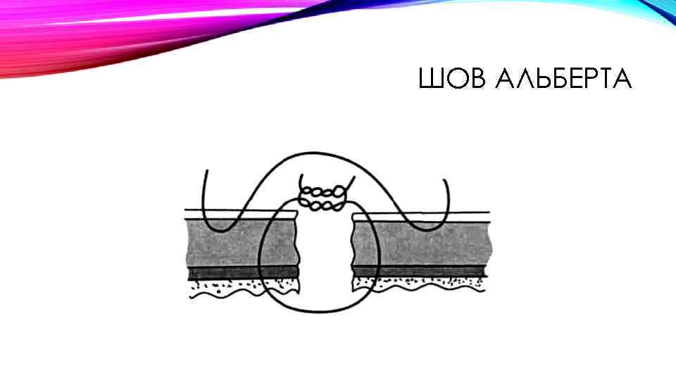 ШОВ АЛЬБЕРТА 