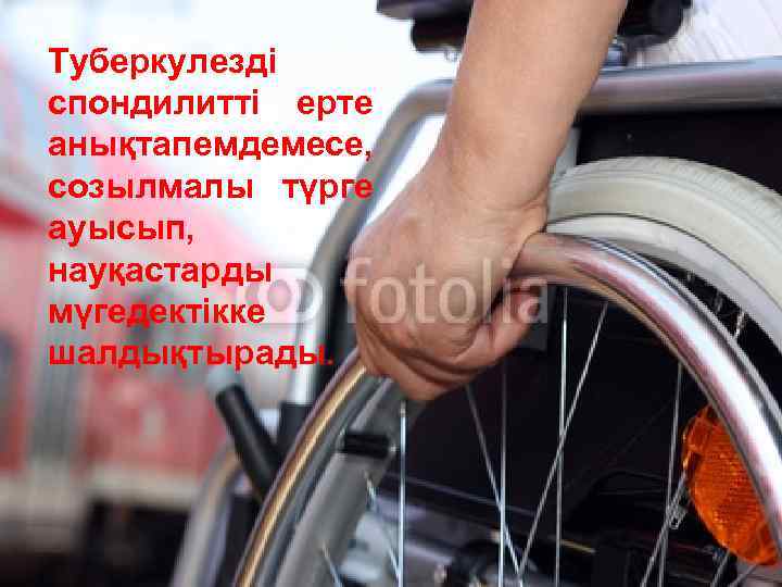 Туберкулезді спондилитті ерте анықтап емдемесе, созылмалы түрге ауысып, науқастарды мүгедектікке шалдықтырады. 