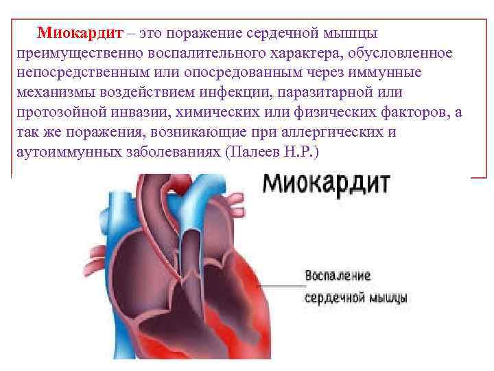 Миокардит – это поражение сердечной мышцы преимущественно воспалительного характера, обусловленное непосредственным или опосредованным через