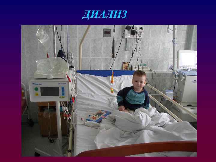 ДИАЛИЗ 