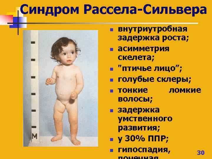 Синдром Рассела-Сильвера n n n n внутриутробная задержка роста; асимметрия скелета; 
