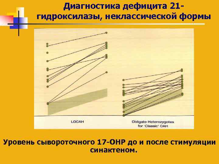 Диагностика дефицита 21 гидроксилазы, неклассической формы Уровень сывороточного 17 -OHP до и после стимуляции