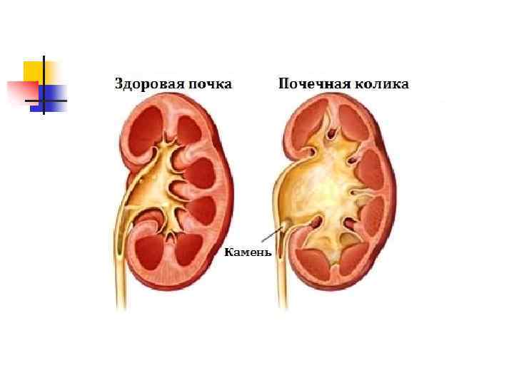 Возможные осложнения и прогноз