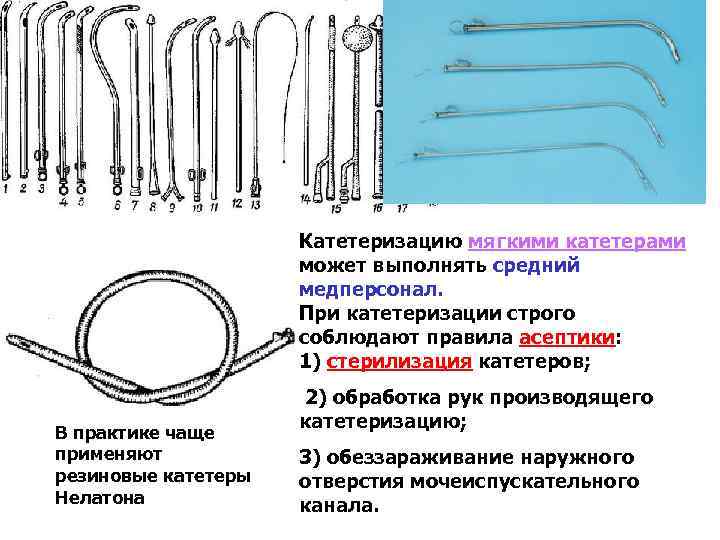 Катетеризацию мягкими катетерами может выполнять средний медперсонал. При катетеризации строго соблюдают правила асептики: 1)