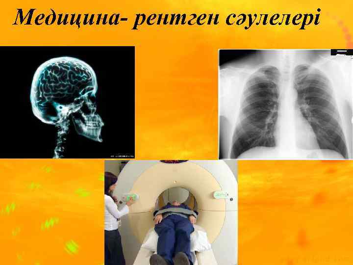 Медицина- рентген сәулелері 