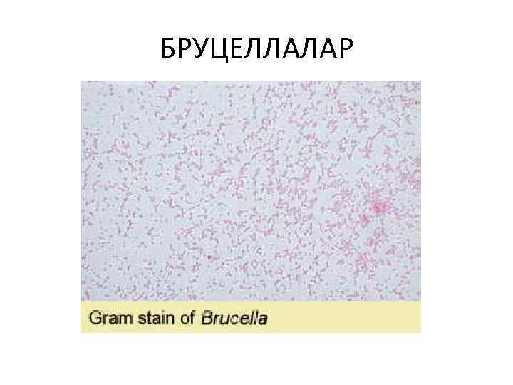 БРУЦЕЛЛАЛАР 