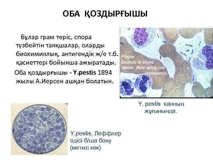 ОБА ҚОЗДЫРҒЫШЫ Бұлар грам теріс, спора түзбейтін таяқшалар, оларды биохимиялық, антигендік ж/е т. б.