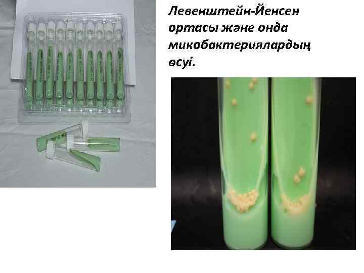 Левенштейн-Йенсен ортасы және онда микобактериялардың өсуі. 