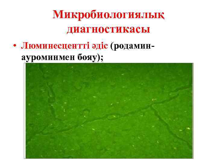 Микробиологиялық диагностикасы • Люминесцентті әдіс (родаминауроминмен бояу); 