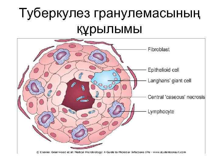 Туберкулез гранулемасының құрылымы 