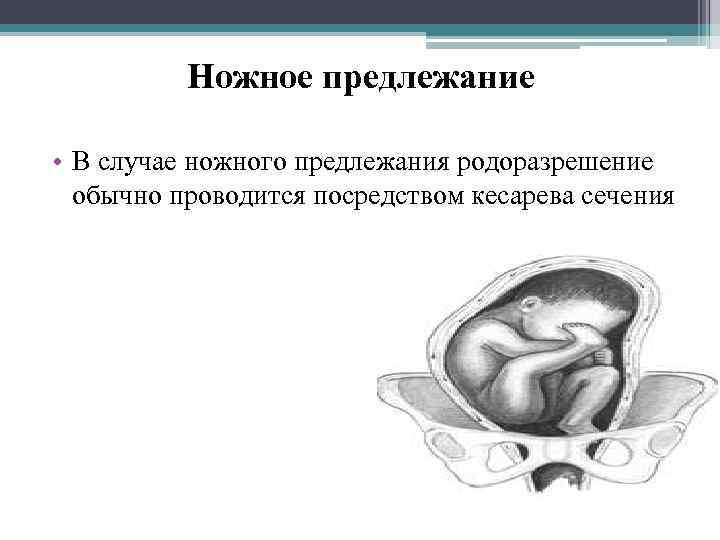 Ножное предлежание • В случае ножного предлежания родоразрешение обычно проводится посредством кесарева сечения 