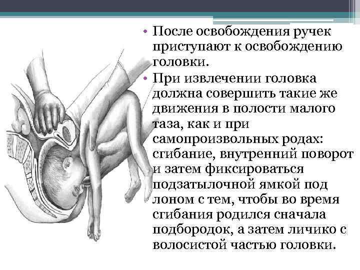  • После освобождения ручек приступают к освобождению головки. • При извлечении головка должна