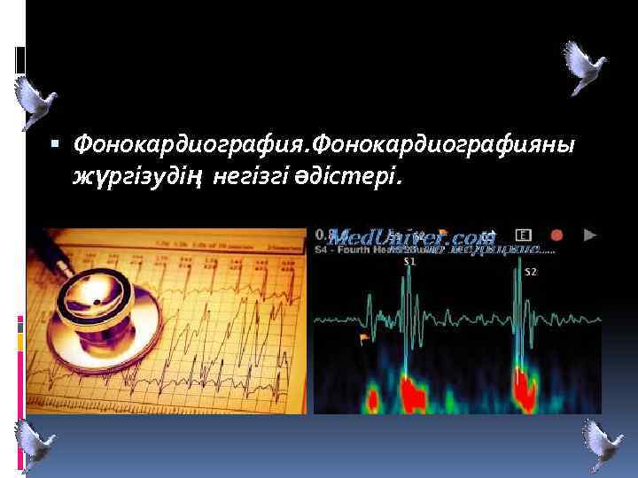  Фонокардиографияны жүргізудің негізгі әдістері. 