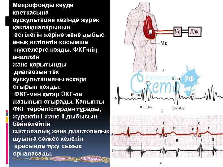 Экг и ад валента. Фонокардиограф Валента.