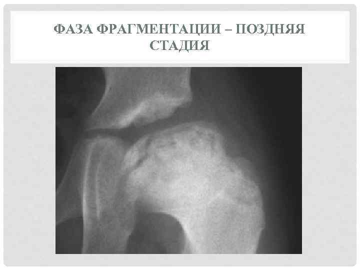ФАЗА ФРАГМЕНТАЦИИ – ПОЗДНЯЯ СТАДИЯ 