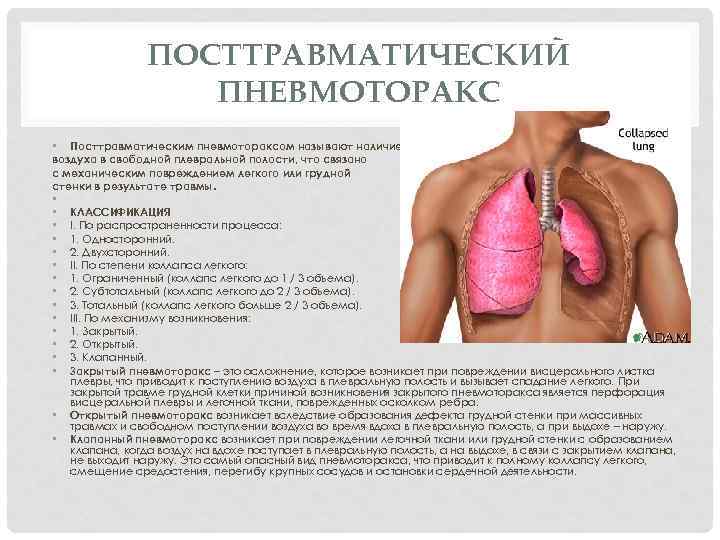 ПОСТТРАВМАТИЧЕСКИЙ ПНЕВМОТОРАКС • Посттравматическим пневмотораксом называют наличие воздуха в свободной плевральной полости, что связано