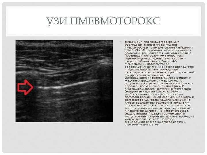 Физикальная картина при пневмотораксе характеризуется