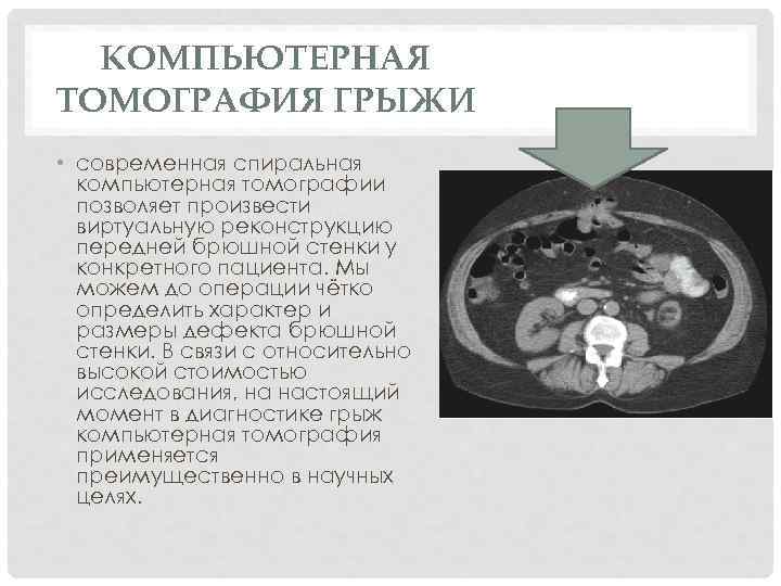 Спиральная компьютерная томография что это