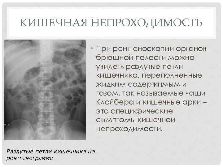 Кишечная непроходимость рентген. Протокол описания рентгенограммы кишечной непроходимости. Рентгенологические симптомы кишечной непроходимости. Кишечная непроходимость рентген описание. Описание рентгена при кишечной непроходимости.