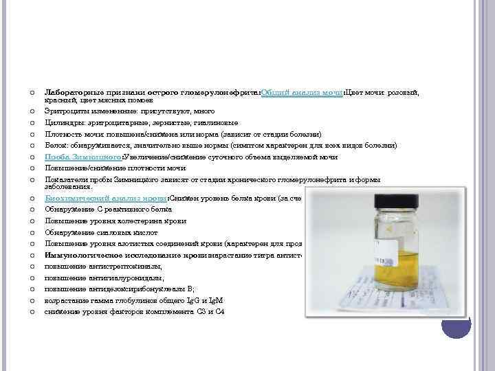  Лабораторные признаки острого гломерулонефрита: Общий анализ мочи: Цвет мочи: розовый, красный, цвет мясных