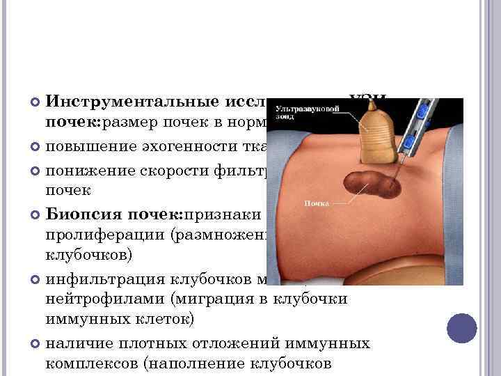 Инструментальные исследования. УЗИ почек: размер почек в норме или уменьшен повышение эхогенности ткани почек