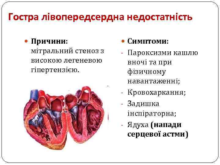 Гостра лівопередсердна недостатність Причини: мітральний стеноз з високою легеневою гіпертензією. Симптоми: - Пароксизми кашлю