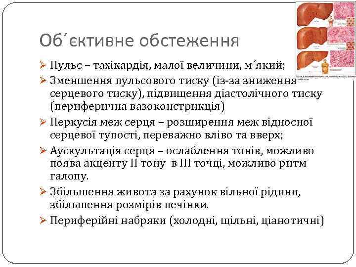 Об´єктивне обстеження Ø Пульс – тахікардія, малої величини, м´який; Ø Зменшення пульсового тиску (із-за