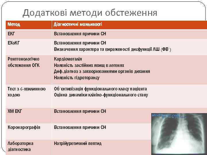 Додаткові методи обстеження Метод Діагностичні можливості ЕКГ Встановлення причини СН ЕХо. КГ Встановлення причини