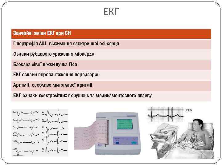 ЕКГ Звичайні зміни ЕКГ при СН Гіпертрофія ЛШ, відхилення електричної осі серця Ознаки рубцевого