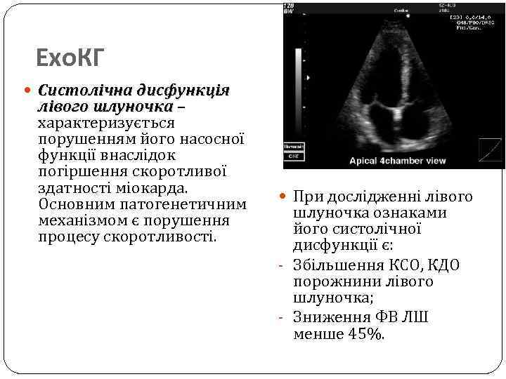 Ехо. КГ Систолічна дисфункція лівого шлуночка – характеризується порушенням його насосної функції внаслідок погіршення