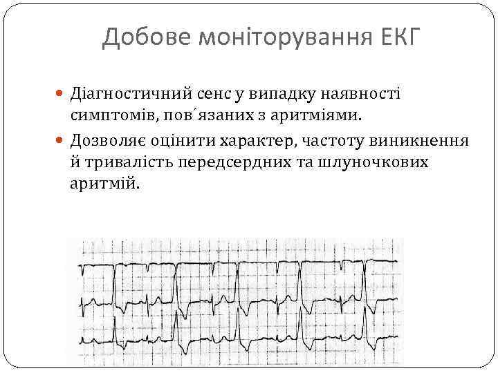 Добове моніторування ЕКГ Діагностичний сенс у випадку наявності симптомів, пов´язаних з аритміями. Дозволяє оцінити