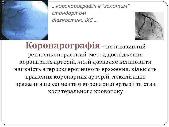 …коронарографія є ”золотим” стандартом діагностики ІХС … Коронарографія – це інвазивний рентгенконтрастний метод дослідження