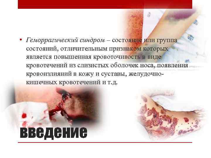  • Геморрагический синдром – состояние или группа состояний, отличительным признаком которых является повышенная