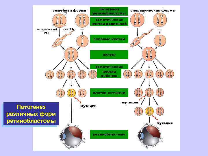 семейная форма патогенез ретинобластомы спорадическая форма соматические клетки родителей нормальный ген Rb половые клетки