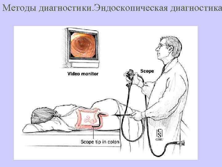 Методы диагностики. Эндоскопическая диагностика 