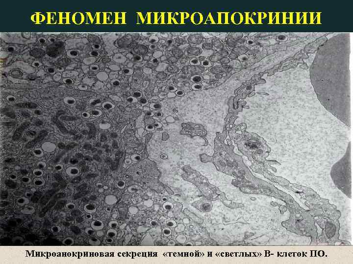 ФЕНОМЕН МИКРОАПОКРИНИИ Микроанокриновая секреция «темной» и «светлых» В- клеток ПО. 
