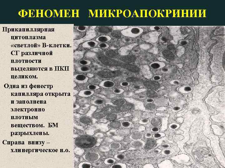 ФЕНОМЕН МИКРОАПОКРИНИИ Прикапиллярная цитоплазма «светлой» В-клетки. СГ различной плотности выделяются в ПКП целиком. Одна