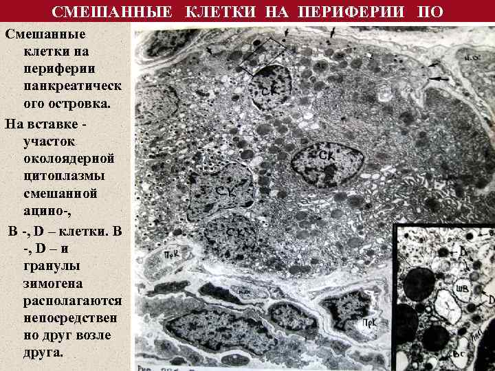СМЕШАННЫЕ КЛЕТКИ НА ПЕРИФЕРИИ ПО Смешанные клетки на периферии панкреатическ ого островка. На вставке