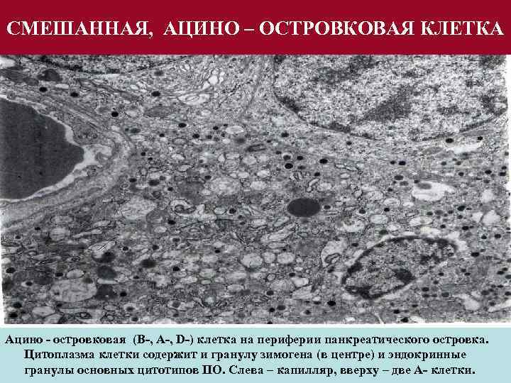 СМЕШАННАЯ, АЦИНО – ОСТРОВКОВАЯ КЛЕТКА Ацино - островковая (В-, А-, D-) клетка на периферии