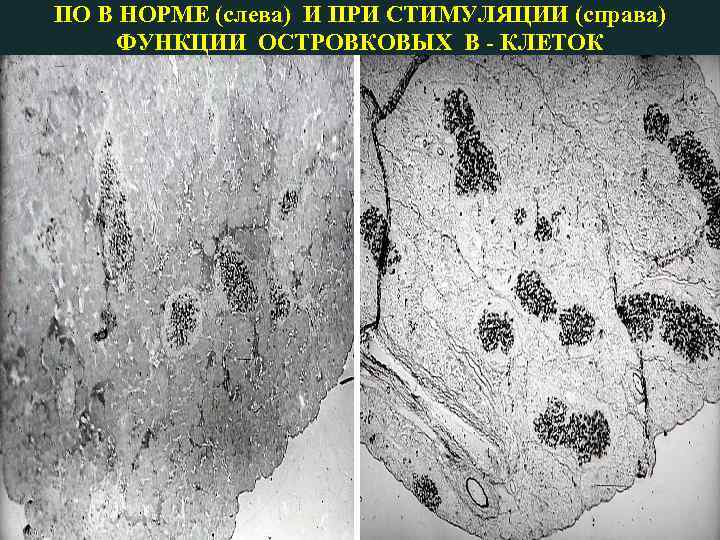 ПО В НОРМЕ (слева) И ПРИ СТИМУЛЯЦИИ (справа) ФУНКЦИИ ОСТРОВКОВЫХ В - КЛЕТОК 