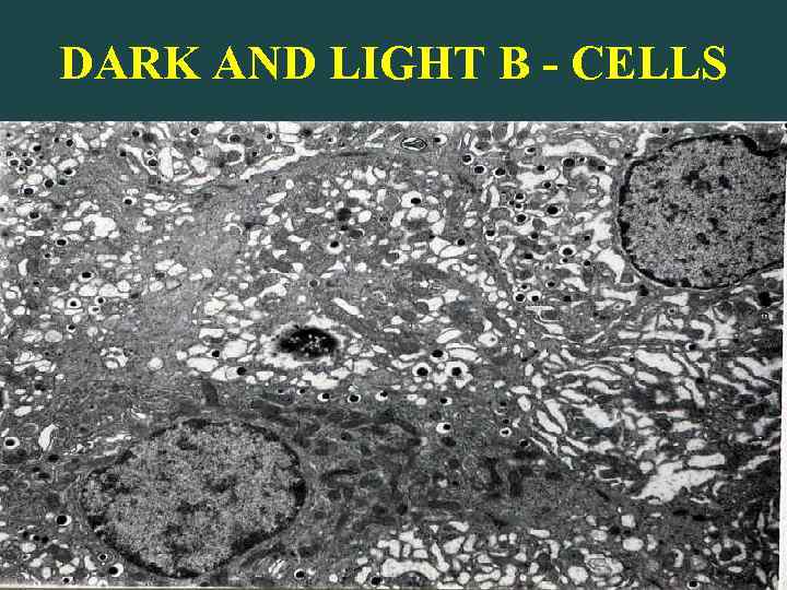DARK AND LIGHT B - CELLS 