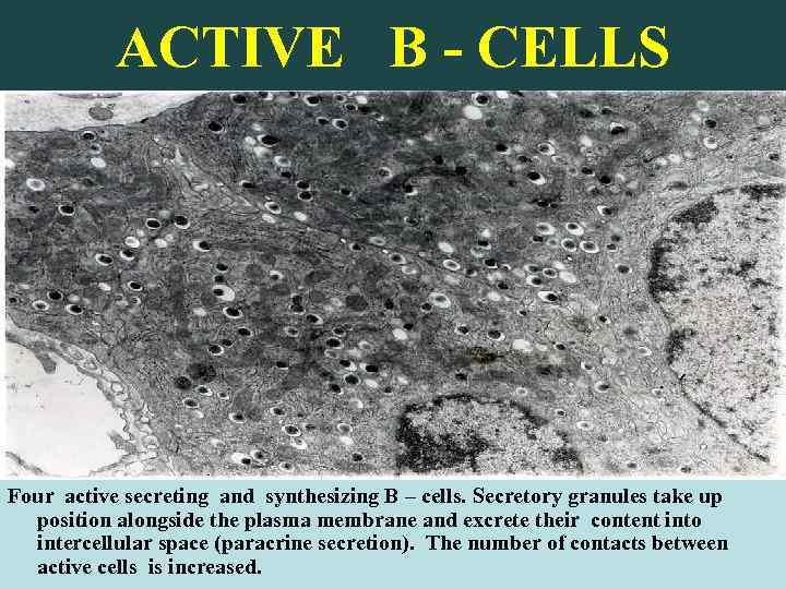 ACTIVE B - CELLS Four active secreting and synthesizing B – cells. Secretory granules