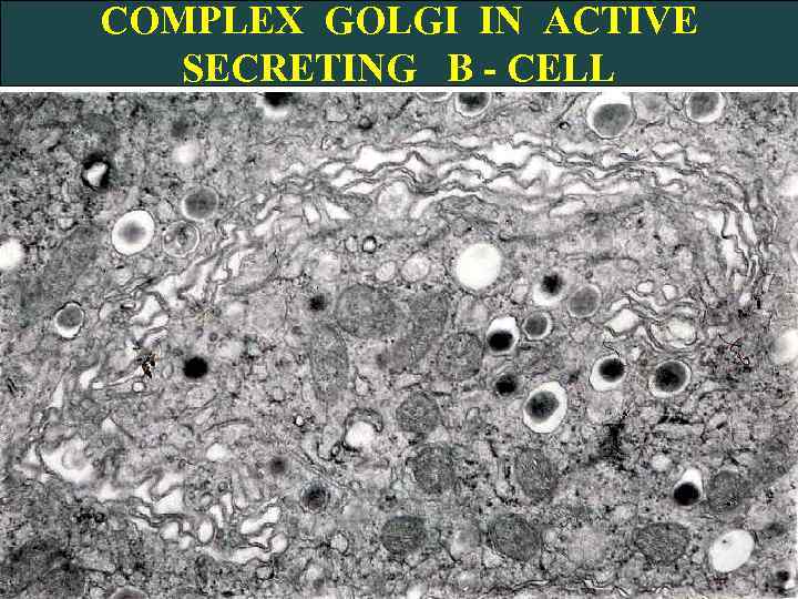 COMPLEX GOLGI IN ACTIVE SECRETING B - CELL 