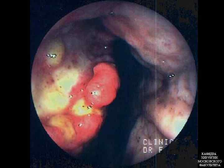 КАФЕДРА ХИРУРГИИ МОСКОВСКОГО ФАКУЛЬТЕТА 