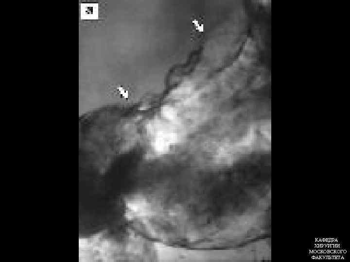 КАФЕДРА ХИРУРГИИ МОСКОВСКОГО ФАКУЛЬТЕТА 